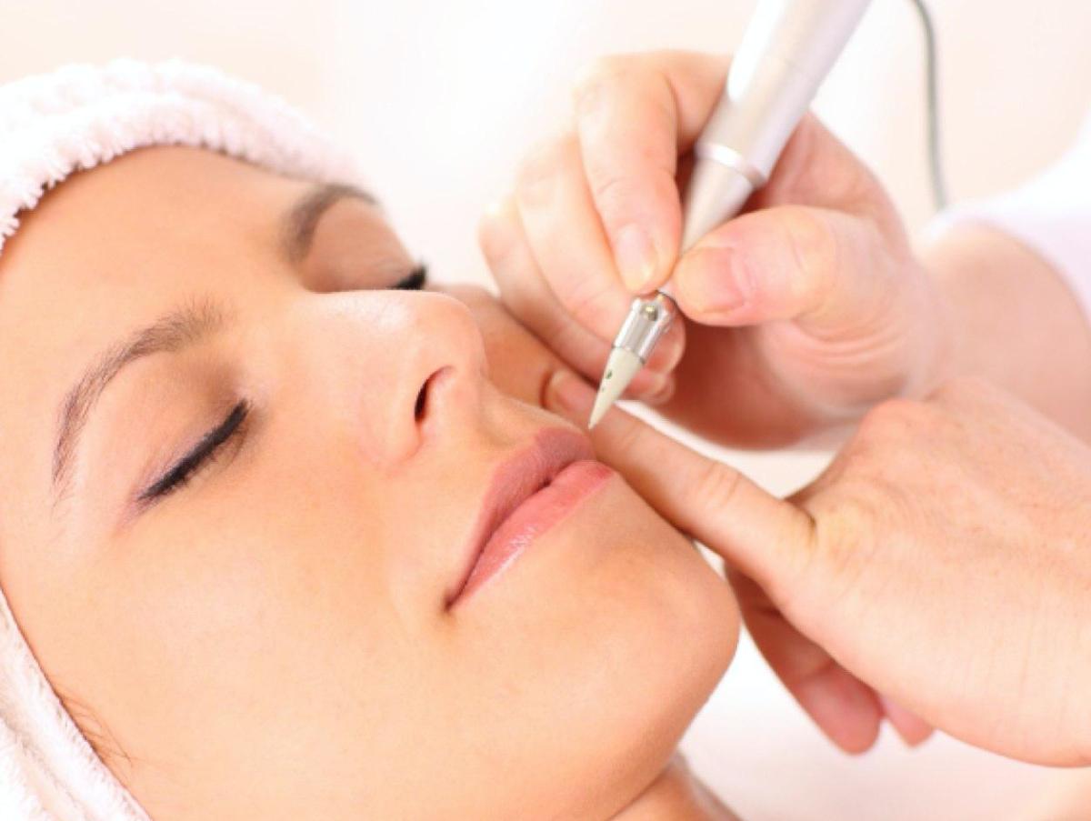 Beauty Lodge | Electrolysis : Hair Removal : Blend or Diathermy | Health  and Beauty Clinic